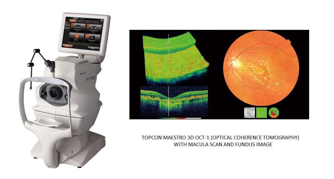 Topcon Maestro 3D OCT1 with macula